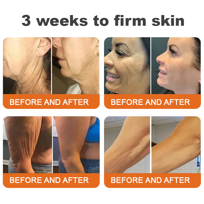 ✨💧Made and Shipped from USA✨Flysmus™ Botox Bee Venom Firming Serum Stick👩‍🔬LAST DAY 70% OFF