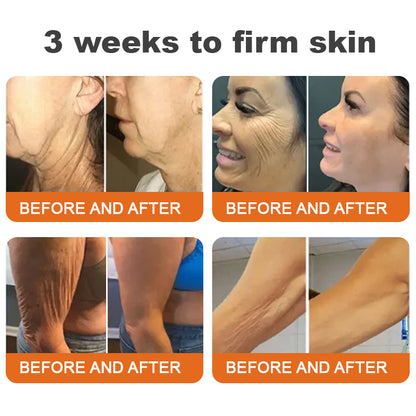 ✨💧Made and Shipped from USA✨Flysmus™ Botox Bee Venom Firming Serum Stick👩‍🔬LAST DAY 70% OFF
