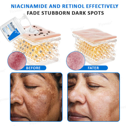 ✨💧(Made and Shipped from USA)✨Rolimey® Advanced Firming & Wrinkle-Reducing Cream (with SPF 50+)✨LAST DAY 60% OFF