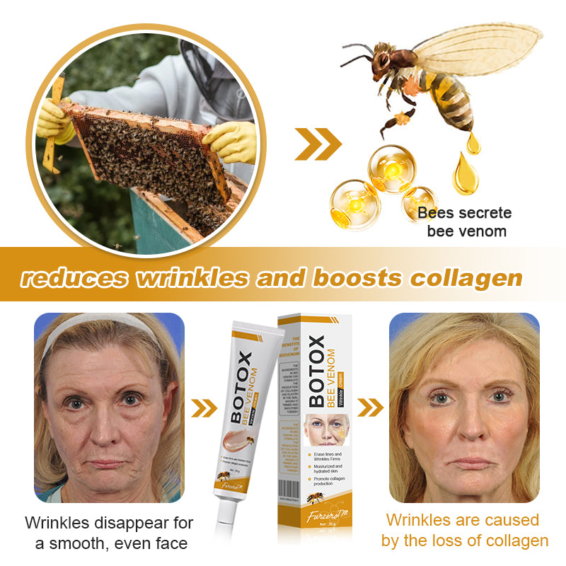 🌞✨Made and Shipped from USA✨Furzero™ Botox Bee Venom Wrinkle Removal Cream-🔥LAST DAY 70% OFF