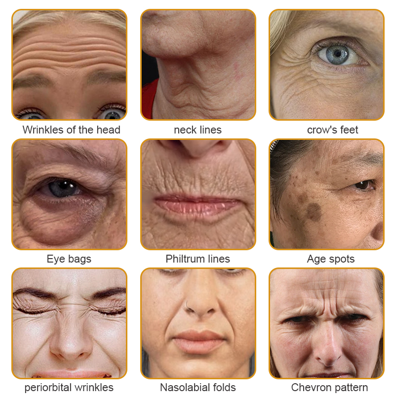 🌞✨Made and Shipped from USA✨Furzero™ Botox Bee Venom Wrinkle Removal Cream-🔥LAST DAY 70% OFF