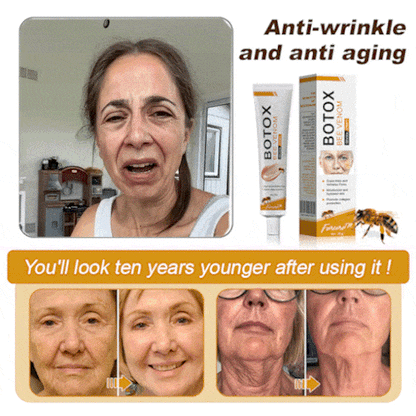 🌞✨Made and Shipped from USA✨Furzero™ Botox Bee Venom Wrinkle Removal Cream-🔥LAST DAY 70% OFF