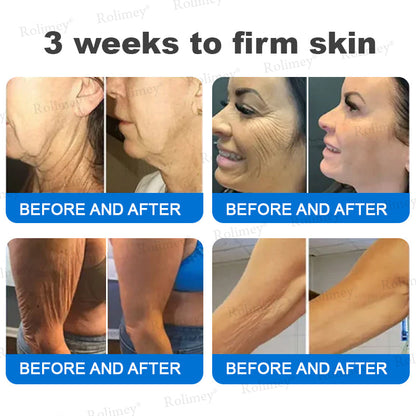 ✨💧(Made and Shipped from USA)✨Rolimey® Advanced Firming & Wrinkle-Reducing Cream (with SPF 50+)✨LAST DAY 60% OFF