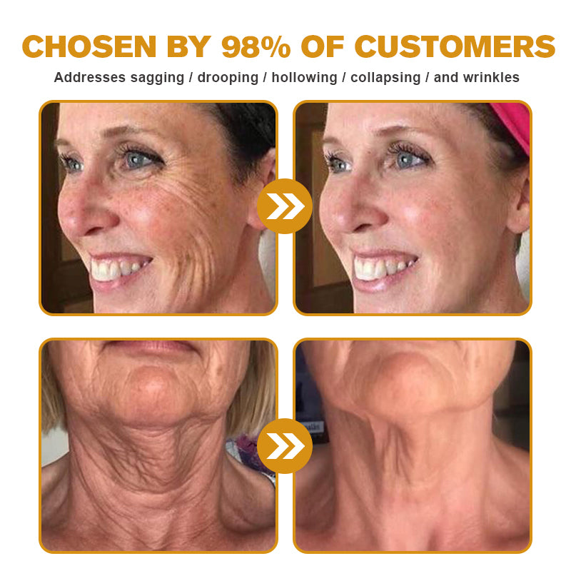 🌞✨Made and Shipped from USA✨Furzero™ Botox Bee Venom Wrinkle Removal Cream-🔥LAST DAY 70% OFF