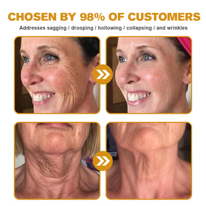 🌞✨Made and Shipped from USA✨Furzero™ Botox Bee Venom Wrinkle Removal Cream-🔥LAST DAY 70% OFF