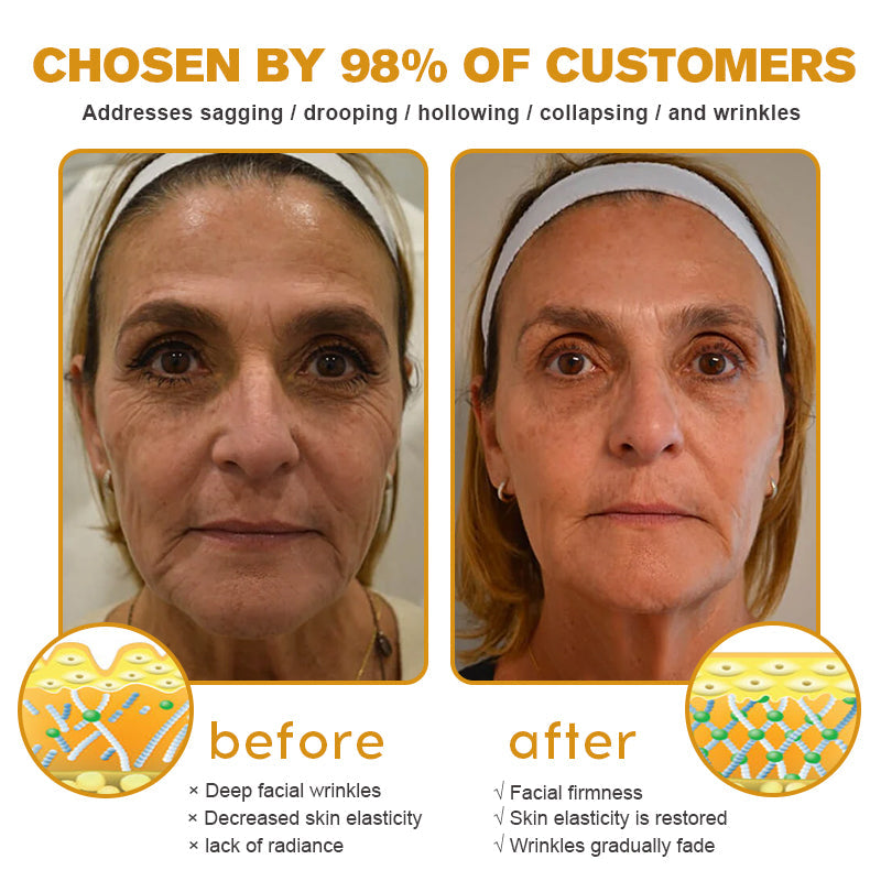 🌞✨Made and Shipped from USA✨Furzero™ Botox Bee Venom Wrinkle Removal Cream-🔥LAST DAY 70% OFF