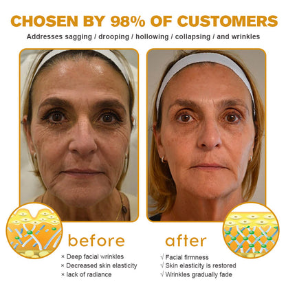 🌞✨Made and Shipped from USA✨Furzero™ Botox Bee Venom Wrinkle Removal Cream-🔥LAST DAY 70% OFF
